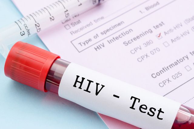 Жителей Хакасии приглашают пройти анонимное обследование на ВИЧ