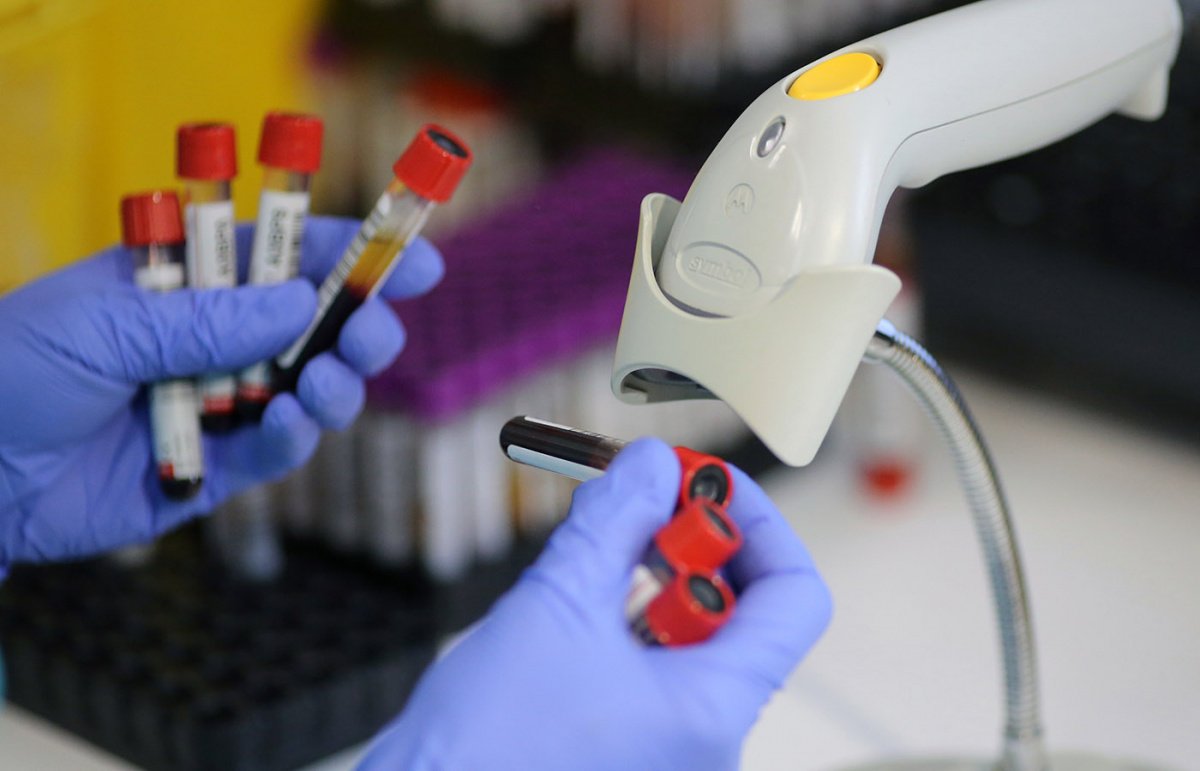 analiz krovi naukarf